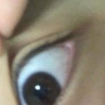 눈두덩이 살 잡아당기면 <b>쌍꺼풀</b> 나오는데