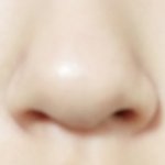 [추반] 고1 겨방 콧볼축소 어떰