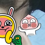 [댓글부탁해] 판에 코수술한 사람 있냐??(사진 큼주의)
