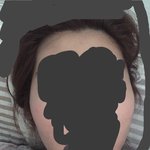 광대 <b>심해</b>?
