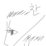 [정말궁금해] <b>쌍수후</b>에 둘중 뭐가 정상이야?