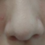 [조언부탁해] 내 피부어떻해ㅠㅠㅠㅠㅜo혐짤미안o