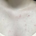 [조언부탁해] 나가슴<b>드름</b> 심각해?