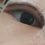 [댓글부탁해] 나 오늘 쌍수했는데 이거 <b>속</b><b>쌍</b>이야?
