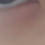 [댓글부탁해] 자고 일어났더니 <b>눈밑</b>이 부풀어있어