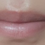 [댓글부탁해] 나 <b>덧니</b>가 있는데 ㅠ