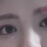<b>쌍수</b>할때 (<b>남자</b>)