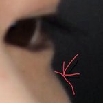 야 애드라 이건 대체 뭐임..? <b>볼살</b>이냐