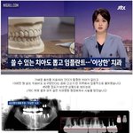 [댓글부탁해] 멀쩡한 <b>치아</b>까지 임플란트 시술한 치과 원장