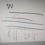 [댓글부탁해] 얘들아 타블렛 고장나본사람ㅠㅠ내꺼 왜이럴까