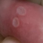 [약간혐주의] 나 너무 고통스러워 살<b>려조</b>ㅠㅠㅠㅠ