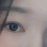 [댓글부탁해] 쌍수 이정도면 잘되지않았음??