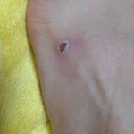 [이것좀봐줘] 쪼리 신는분중에 발 안까지시나요?