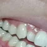 [댓글부탁해] 와 어금니랑 <b>앞니</b> 색깔 차이좀봐