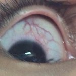 (혐주의)원데이렌즈끼는애들 들어오ㅓ보ㅓㅠㅠㅠㅠ