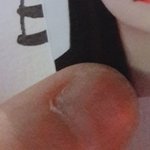 [드루와] 손톱 뜯는 버릇 고쳐 봄!