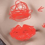[조언부탁해] 이런건 무슨 성형해야돼?