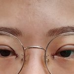 [댓글부탁해] 나 <b>쌍수</b> 2주찬데 잘됐당!!!