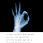 [댓글부탁해] <b>성장</b>판이 열려있는지 확인하는 법