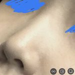 코 ㄱㅊ ? 추반점