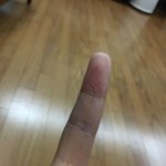 [이것좀봐줘] <b>슈발</b> 얘들아 내 손가락 좀 봐주라