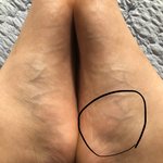 [약간혐짤] 여기에 자꾸 <b>경련</b> 일어나는데 왜 이래 ㅠㅠ