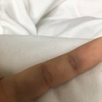 [꼭조언부탁] 나 손가락 <b>인대</b> 늘어난 거임?