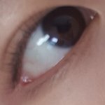 [댓글부탁해] 애들아 나 <b>꼬막눈</b> 심한거야 ㅠㅠ?!?!?!?!
