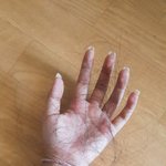 [꼭조언부탁] <b>탈모</b>인지 진단좀