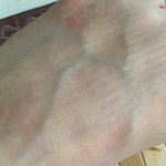 [댓글부탁해] 줄<b>무니</b> 양말 신었더니 발에 자국생김ㅌㅋㅋ