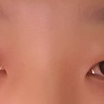 [댓글부탁해] 쌍수하고싶은데 못하게해