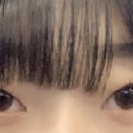 [드루와] 얘들아 나 쌍수할까말까!!!!!!!!!!!!!!