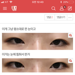[조언부탁해] <b>눈매</b>교정 잘아는 사람 들어와죵