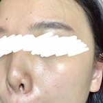 [드루와] 피부 좋아지고 싶어? 이 방법인 듯 ㄹㅇ (후기 사진...