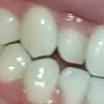 [댓글부탁해] 치아<b>미백</b>제 쓰는중인데 하얘진거같아?