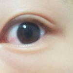 [댓글부탁해] 얘들아 혹시 많이 울면 눈이 이렇게 돼?