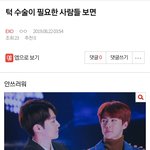 [EXO] ⬇️<b>턱</b> 수술이 필요한 <b>사람</b>들 보면 여기서봐