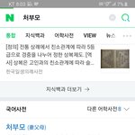 <b>정관</b>수술 풀라고 하는 아내와 어머니 처부모