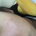 [댓글부탁해] 얘들아 이런 피부는 어떻게 <b>개선</b>해야돼ㅠㅠ?