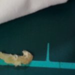 [댓글부탁해] 와 너희들 블랙<b>헤드</b> 제대로 짜본적있니