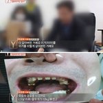 [댓글부탁해] 싸이코패스 치과<b>의사</b>