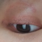 [댓글부탁해] 나 쌍액때문에 눈 ㅈ<b>창남</b>