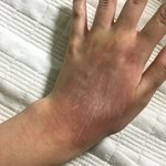 [댓글부탁해] 강아지가 손 긁었는데 <b>주글</b>거같음