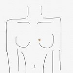 [이것좀봐줘] <b>가슴</b>에 좀 옛날부터 멍이있는데 이거 ㄹㅇ로 왜이래...