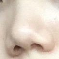[꼭조언부탁] <b>돼지</b>코인데 성형하고싶어ㅠㅠ