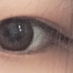 [댓글부탁해] 나 쌍수 다시 할까?
