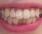 [19] 나 많이 <b>심각</b>해?ㅠ