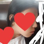 시ㅡ발 나 <b>무턱</b>이라서 죽고싶음