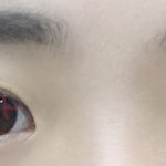 다래끼<b>난거</b> 티 많이 나냐...
