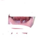 <b>잇몸</b>에 구내염 난거 실화냐??